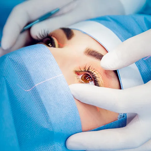 Procedimento de cirurgias vítreorretinianas com laser e vitreófagos de alta performance, utilizando tecnologia avançada.