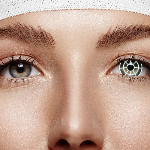 Close do olho durante capsulotomia, evidenciando abertura na cápsula do cristalino para restaurar a visão após cirurgia de catarata.