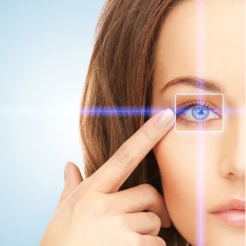 Representação da cirurgia a laser de endociclofotocoagulação, com feixe aplicado no corpo ciliar para controle do glaucoma.