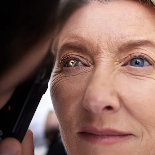 Paciente idosa em centro cirúrgico realizando cirurgia de catarata a laser, com equipamento especializado posicionado sobre o olho.