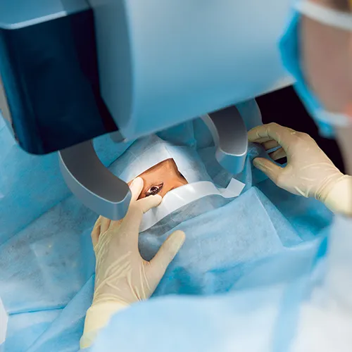 Procedimento de cirurgia de ceratocone em centro cirúrgico, com paciente posicionado sob campo estéril e foco no olho tratado.