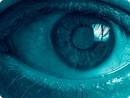 olho com catarata, imagem close-up