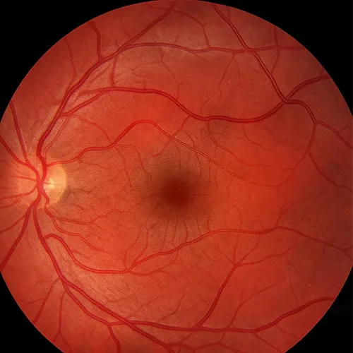 ilustração da mácula