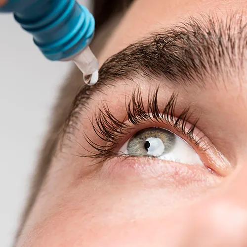 aplicação de colírio para tratamento da síndrome do olho seco