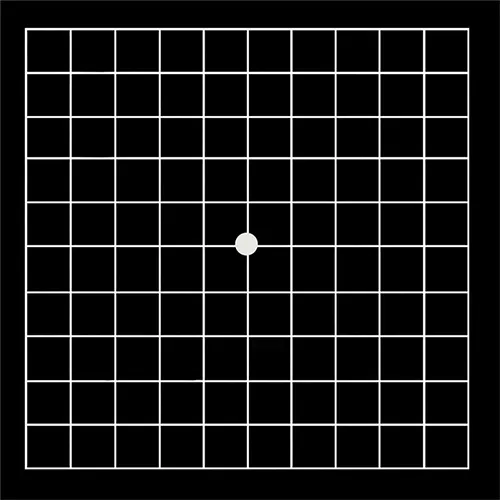Imagem de um exame oftalmológico (exame ocular) de Função macular – avaliação usada para detectar alterações visuais centrais, realizado nos hospitais de olhos da Rede Vision One.