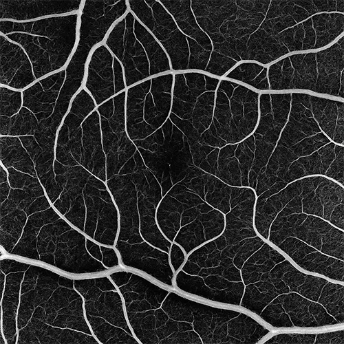 Imagem de um exame oftalmológico (exame ocular) de OCT – exame de imagem de alta definição para avaliar a retina, realizado nos hospitais de olhos da Rede Vision One.