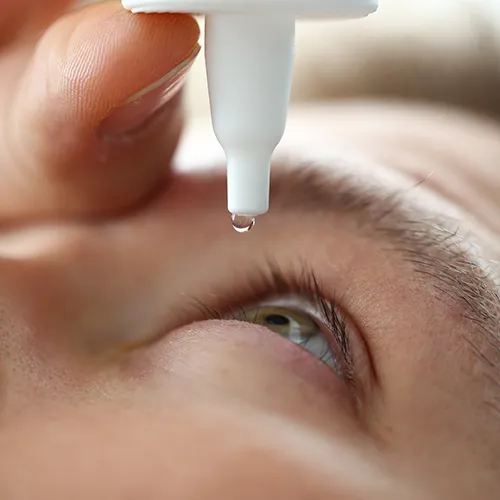 Imagem de um exame oftalmológico (exame ocular) de Rosa Bengala – coloração usada para avaliação da superfície dos olhos, realizado nos hospitais de olhos da Rede Vision One.
