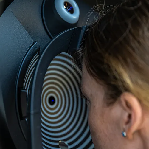 Imagem de um exame oftalmológico (exame ocular) de Ceratoscopia – análise detalhada da córnea para diagnóstico visual, realizado nos hospitais de olhos da Rede Vision One.