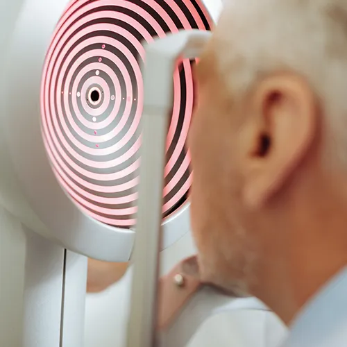 Imagem de um exame oftalmológico (exame ocular) de Ceratoscopia computadorizada – análise precisa da córnea para diagnóstico, realizado nos hospitais de olhos da Rede Vision One.