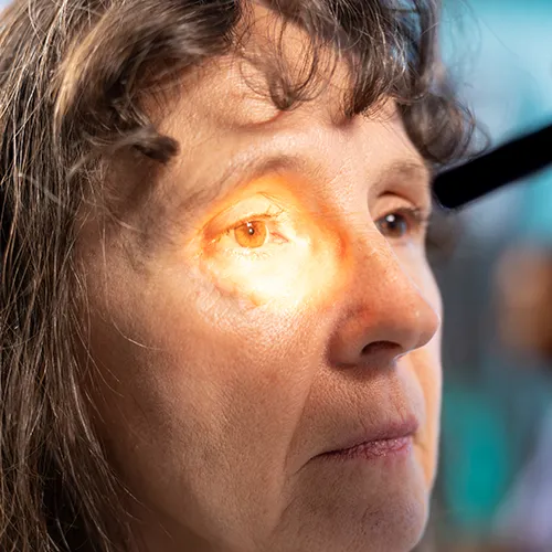 Imagem de um exame oftalmológico (exame ocular) de Estereofoto de papila – exame fotográfico para acompanhar o nervo óptico, realizado nos hospitais de olhos da Rede Vision One.