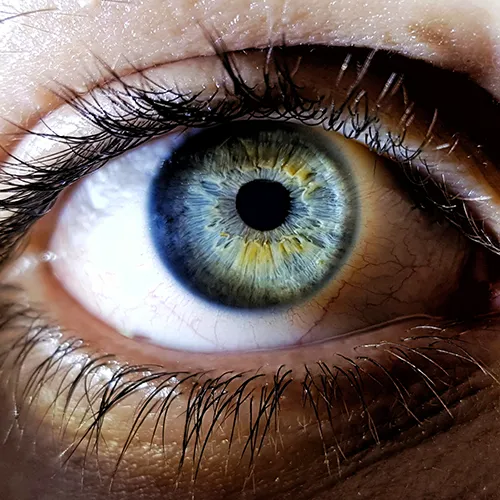 Imagem de um exame oftalmológico (exame ocular) de Segmento anterior – registro fotográfico usado em diagnósticos oftalmológicos, realizado nos hospitais de olhos da Rede Vision One.