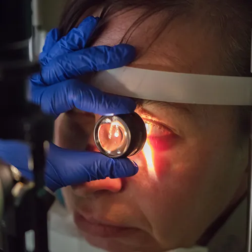 Imagem de um exame oftalmológico (exame ocular) de Gonioscopia – avaliação ocular importante no diagnóstico de glaucoma, realizado nos hospitais de olhos da Rede Vision One.