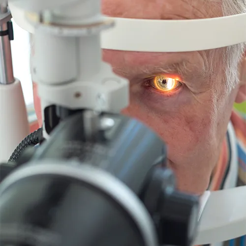 Imagem de um exame oftalmológico (exame ocular) de Mapeamento de retina – exame detalhado do fundo ocular, realizado nos hospitais de olhos da Rede Vision One.