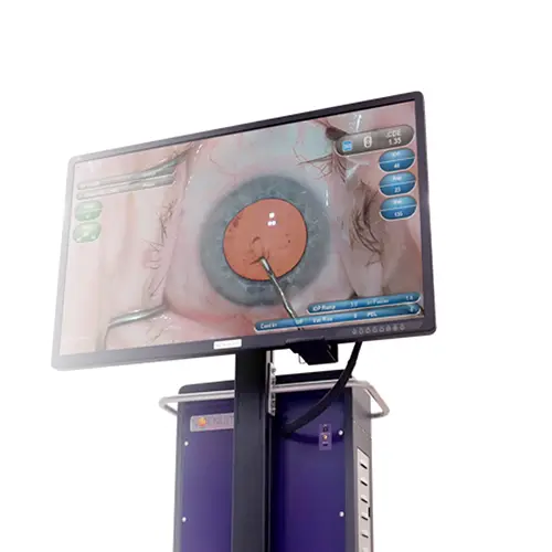 Sistema NGENUITY para visualização digital em cirurgia oftalmológica com alta definição e precisão