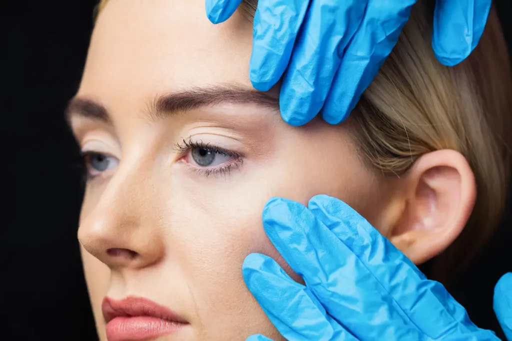 Fox eyes: o que é, para quem é indicado e como evitar erros na cirurgia