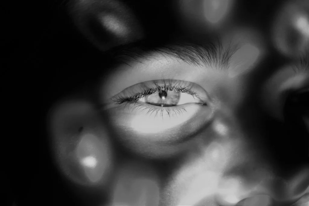 O que é glaucoma e por que ele é conhecido como “ladrão silencioso da visão”?